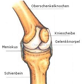 Knie-vor-der-Operation